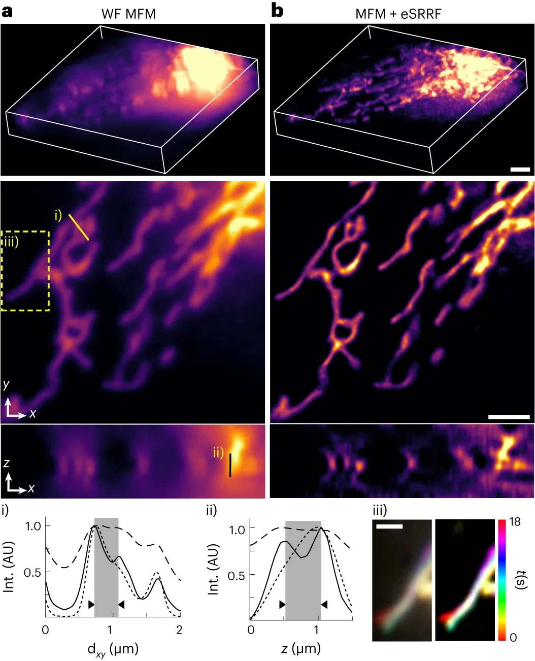 eSRRFによる3D live-cell超解像画像